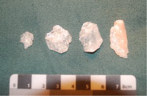 Selection of Quartz Flakes